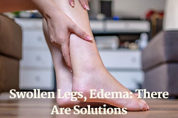 Swollen Legs, Edema: There Are Solutions- Health Care& Fashion